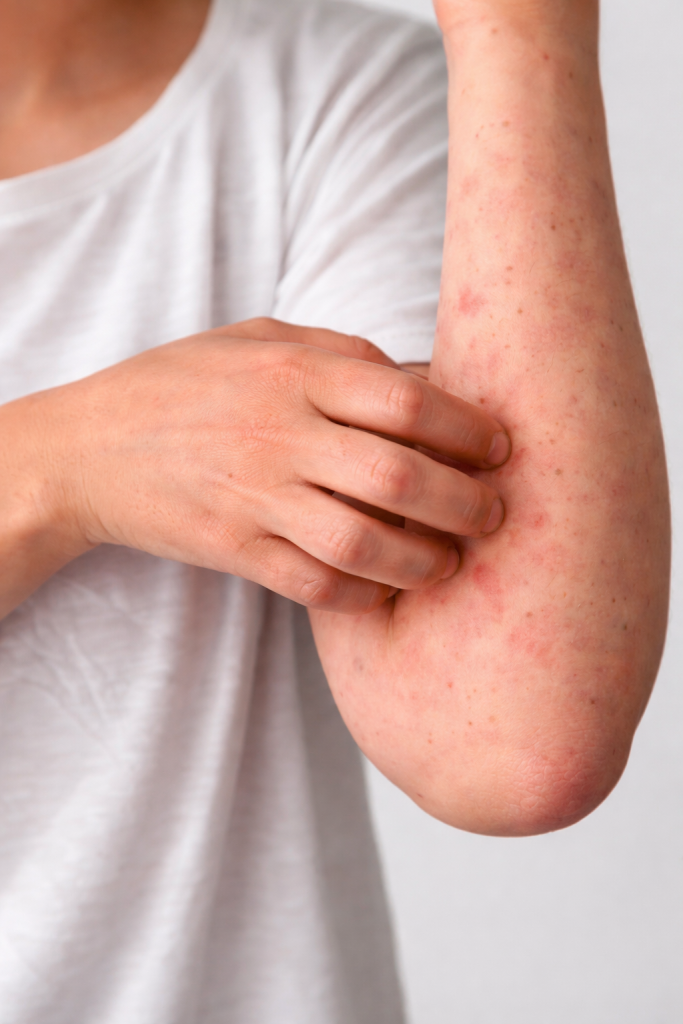 Best Allergies Ayurvedic Treatment in Dubai